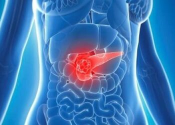 Phẫu thuật thành công bệnh nhân 19 tuổi bị nang đầu tụy