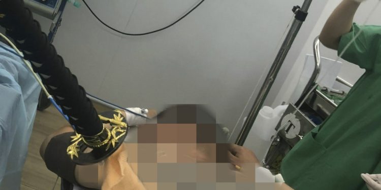 Cấp cứu nạn nhân bị kiếm đâm sâu vùng thắt lưng