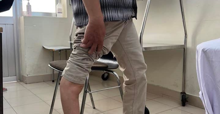 Chỉnh hình xương khớp – Mang phép màu đến bệnh nhân di chứng do sốt bại liệt