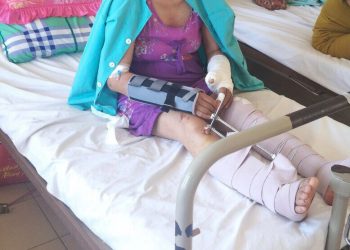 Cứu sống bệnh nhân gãy hở tứ chi do tai nạn giao thông