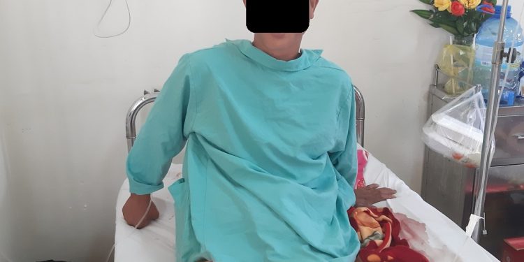 Cảnh báo việc bó thuốc Bắc-Nam & lá cây sau các chấn thương