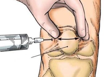 Chiêu sinh lớp đào tạo “Kỹ thuật tiêm khớp, tiêm gân”