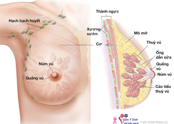 Phòng ngừa ung thư vú