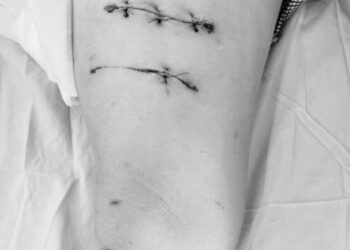 Cảnh báo nuôi động vật hoang dã tại nhà