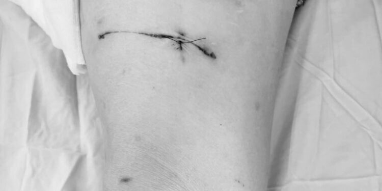 Cảnh báo nuôi động vật hoang dã tại nhà