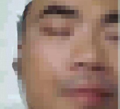 Điều trị phẫu thuật thành công bệnh lý co giật nửa mặt tại Bệnh viện Đa khoa tỉnh Khánh Hòa