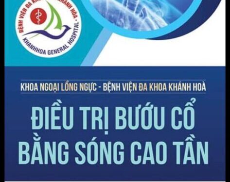 Điều trị bướu cổ bằng sóng cao tần cùng chuyên gia Bệnh viện Đại học Y Dược TP. Hồ Chí Minh