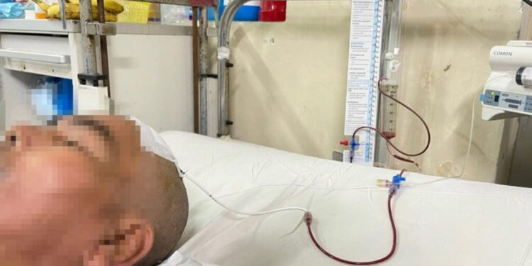 Kết hợp dẫn lưu và sử dụng Alteplase – Điều trị chảy máu não thất có giãn não thất cấp tính