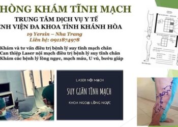 Khám bệnh tĩnh mạch tại Bệnh viện Đa khoa tỉnh Khánh Hòa
