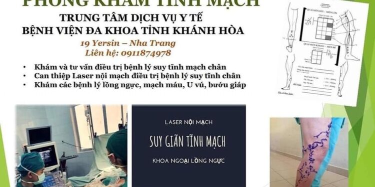 Khám bệnh tĩnh mạch tại Bệnh viện Đa khoa tỉnh Khánh Hòa