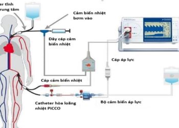 Ứng dụng hệ thống PiCCO trong điều trị sốc nhiễm khuẩn có hoặc không có lọc máu liên tục