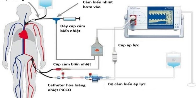 Ứng dụng hệ thống PiCCO trong điều trị sốc nhiễm khuẩn có hoặc không có lọc máu liên tục
