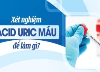 Tầm quan trọng của axit uric máu ở bệnh nhân đái tháo đường type 2 có biến chứng suy thận mạn