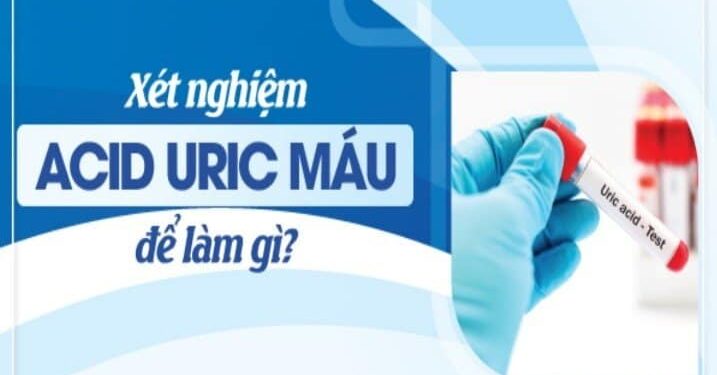 Tầm quan trọng của axit uric máu ở bệnh nhân đái tháo đường type 2 có biến chứng suy thận mạn