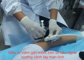 Huyết tương giàu tiểu cầu và hiệu quả điều trị trên hệ cơ xương khớp