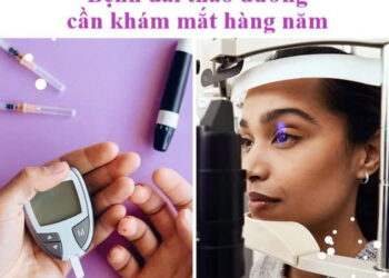 Khô mắt liên quan đến bệnh đái tháo đường