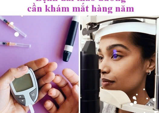 Khô mắt liên quan đến bệnh đái tháo đường