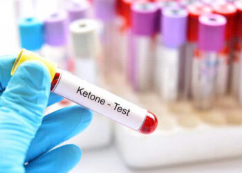 Các yếu tố nguy cơ nhiễm toan ceton khi sử dụng thuốc ức chế sglt-2