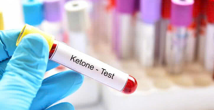 Các yếu tố nguy cơ nhiễm toan ceton khi sử dụng thuốc ức chế sglt-2