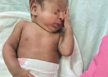 Lần đầu tiên tại Bệnh viện Đa khoa Khánh Hòa: Khoa Nhi cứu sống trẻ sơ sinh “cực non” tuổi thai 26 tuần sinh ra chỉ nặng 700 gram!