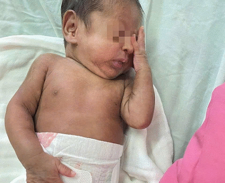 Lần đầu tiên tại Bệnh viện Đa khoa Khánh Hòa: Khoa Nhi cứu sống trẻ sơ sinh “cực non” tuổi thai 26 tuần sinh ra chỉ nặng 700 gram!