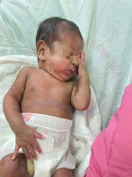 Lần đầu tiên tại Bệnh viện Đa khoa Khánh Hòa: Khoa Nhi cứu sống trẻ sơ sinh “cực non” tuổi thai 26 tuần sinh ra chỉ nặng 700 gram!