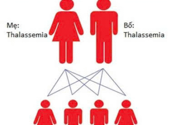 Vai trò của điện di hemoglobin trong chẩn đoán bệnh lý huyết sắc tố