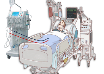 Kỳ tích cứu sống chàng trai trẻ bị điện giật nhờ kỹ thuật “làm lạnh cơ thể” tại Bệnh viện Đa khoa Khánh Hòa