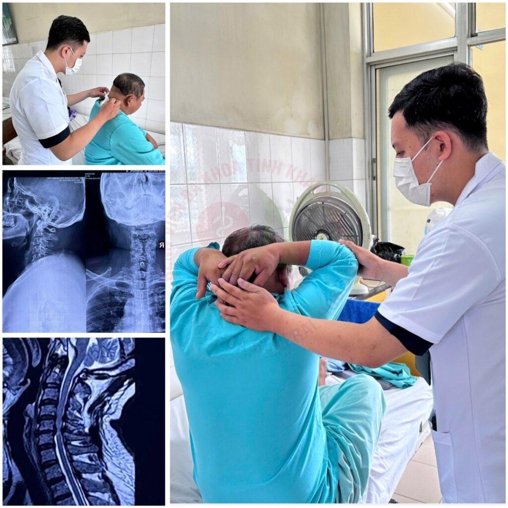 Kỹ thuật Shiraishi phẫu thuật cột sống cổ hẹp ống sống cổ khoa ngoại cột sống Bệnh viện Đa khoa Khánh Hòa