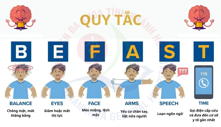 quy tắc BEFAST đột quỵ giờ vàng cấp cứu đột quỵ dấu hiệu đột quỵ bệnh viện đa khoa khánh hòa đột quỵ
