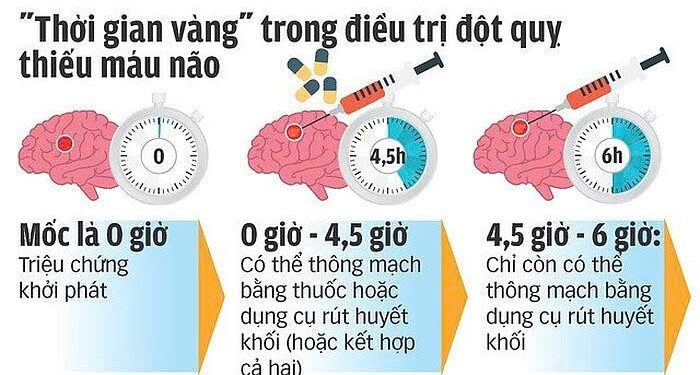 Ngày Đột quỵ Thế giới 29/10: Nhận biết sớm – Cứu sống kịp thời với quy tắc BEFAST
