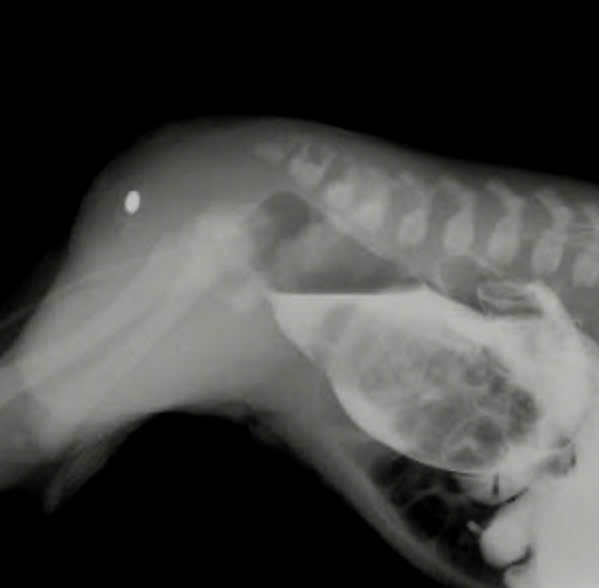 Dị tật Hậu môn Trực tràng
Tạo hình hậu môn trẻ sơ sinh
phẫu thuật Pena
trẻ không có hậu môn
Ngoại nhi Khánh Hòa