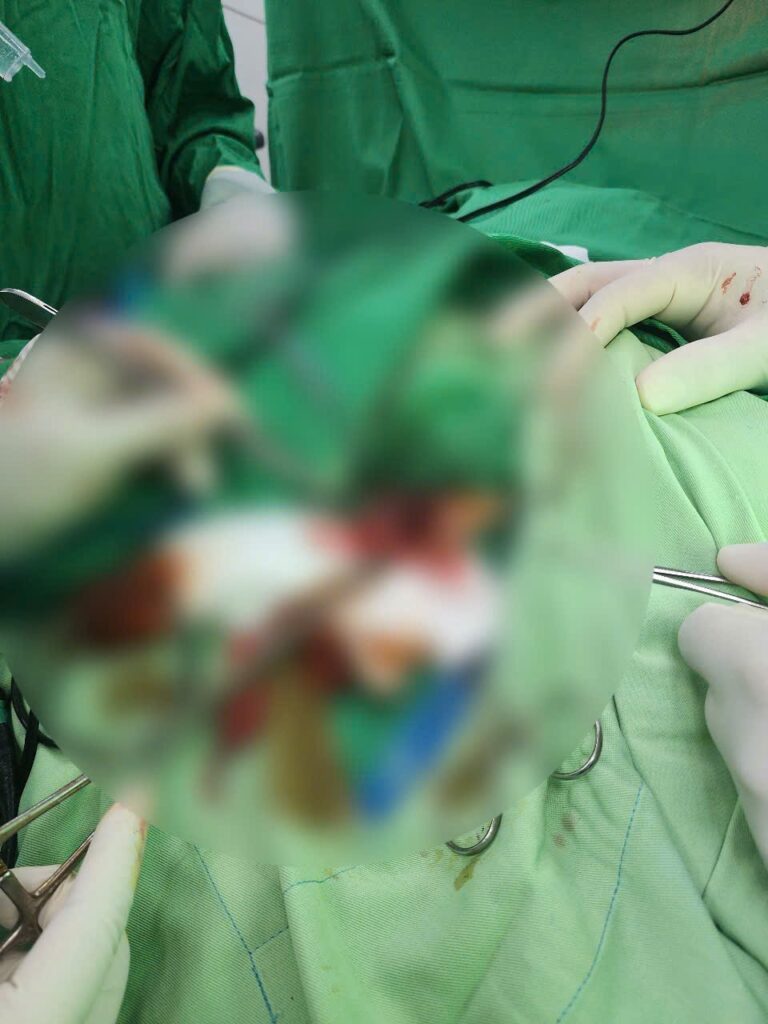 Dị tật Hậu môn Trực tràng
Tạo hình hậu môn trẻ sơ sinh
phẫu thuật Pena
trẻ không có hậu môn
Ngoại nhi Khánh Hòa