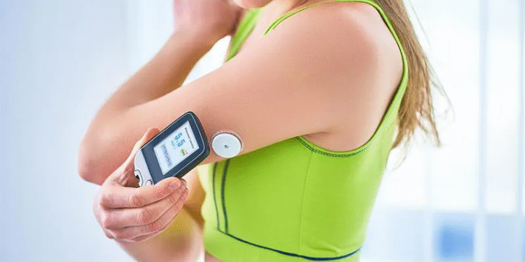 CGM – Theo dõi đường huyết liên tục: Giải pháp an toàn hiện đại cho người bệnh đái tháo đường