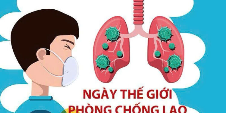 Hưởng ứng Ngày Thế giới Phòng chống Lao 24/3: “Đúng vậy! Chúng ta có thể chấm dứt bệnh lao!”
