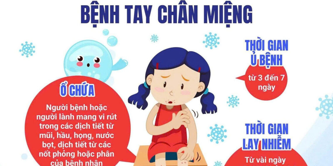 Bệnh tay chân miệng: Dấu hiệu nhận biết và biện pháp phòng ngừa hiệu quả