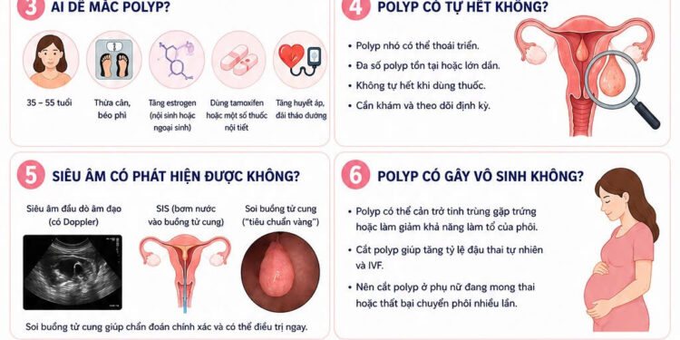 Polyp lòng tử cung Polyp nội mạc tử cung rong kinh bất thường phẫu thuật nội soi buồng tử cung dấu hiệu polyp tử cung Bệnh viện Đa khoa Khánh Hòa