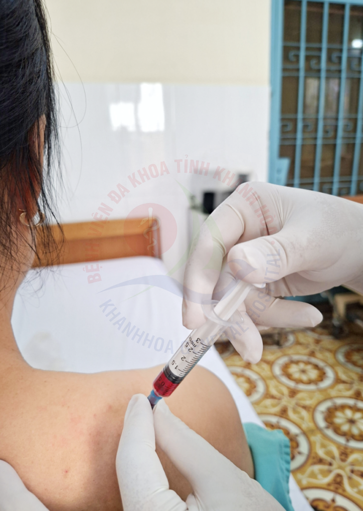 Thủy châm Thủy châm là gì? tiêm thuốc vào huyệt điều trị bằng thủy châm thủy châm tại Khánh Hòa khoa Y học Cổ truyền