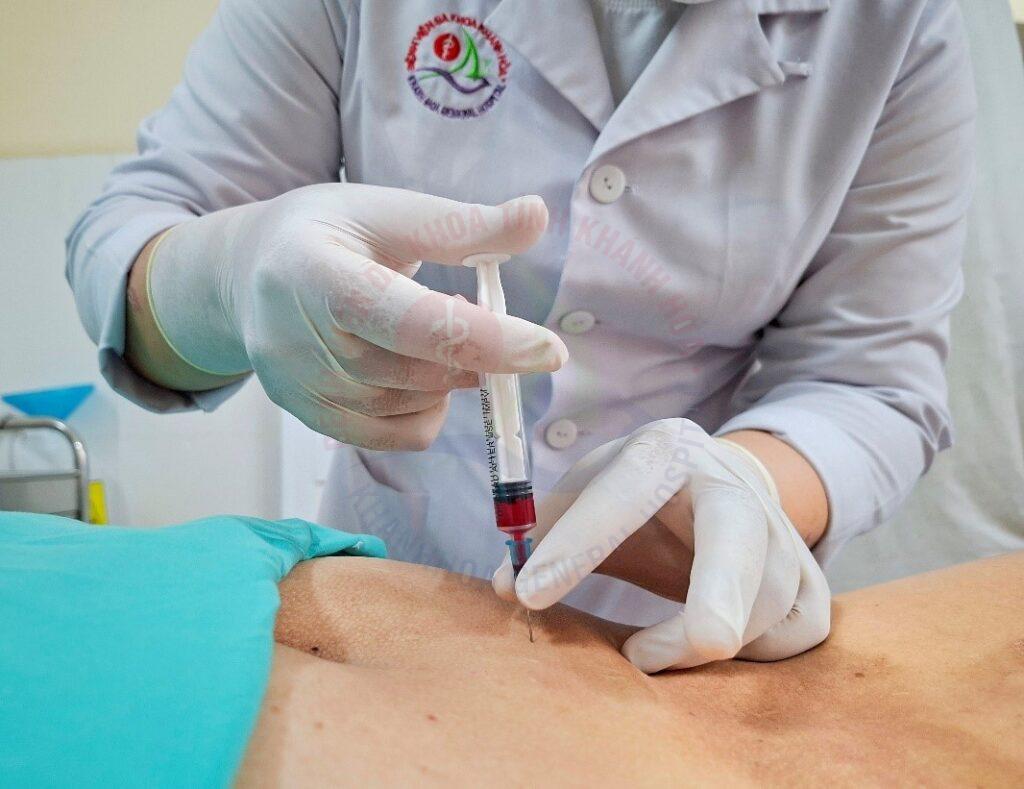 Thủy châm Thủy châm là gì? tiêm thuốc vào huyệt điều trị bằng thủy châm thủy châm tại Khánh Hòa khoa Y học Cổ truyền