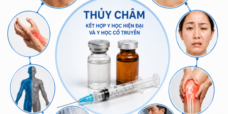 Thủy châm Thủy châm là gì? tiêm thuốc vào huyệt điều trị bằng thủy châm thủy châm tại Khánh Hòa khoa Y học Cổ truyền