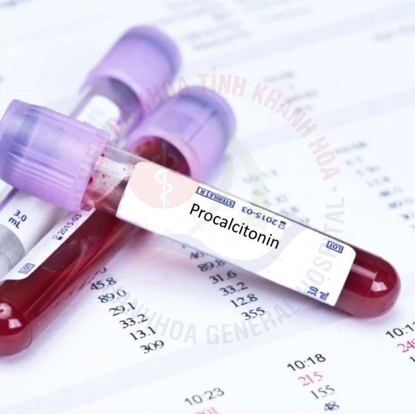 Xét nghiệm Procalcitonin Xét nghiệm PCT nhiễm trùng huyết BVĐK Khánh Hòa chẩn đoán nhiễm khuẩn