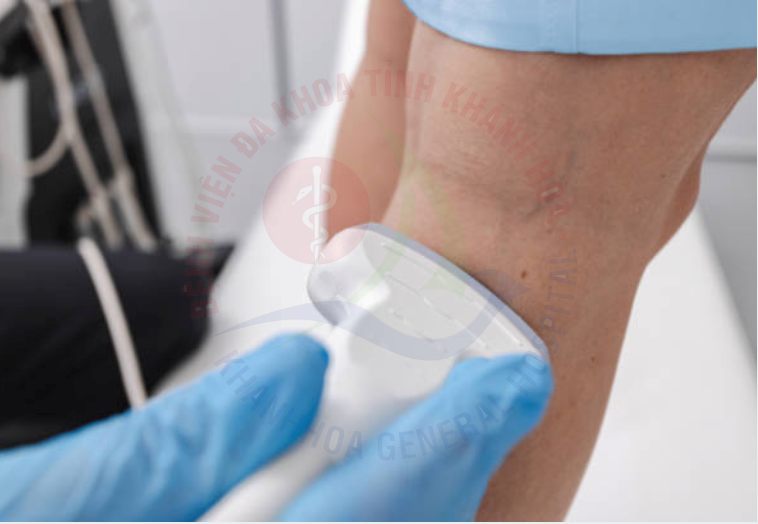 suy van tĩnh mạch chi dưới suy giãn tĩnh mạch chân siêu âm Doppler tĩnh mạch triệu chứng suy tĩnh mạch điều trị suy tĩnh mạch chi dưới Bệnh viện Đa khoa Khánh Hòa